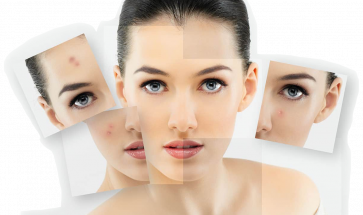  SSR Bőrfiatalítás